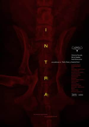 Intra