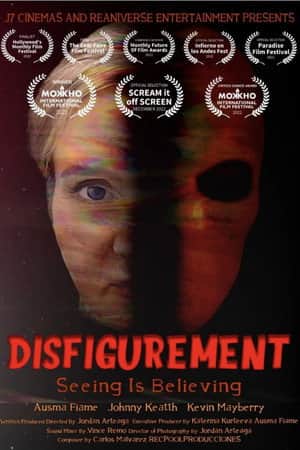 Disfigurement