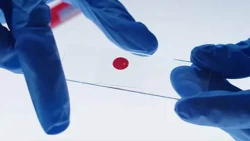 Blood Pattern Analysis
