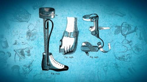 Orthopedics