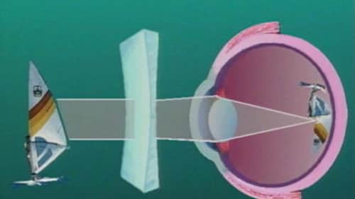 The Eye