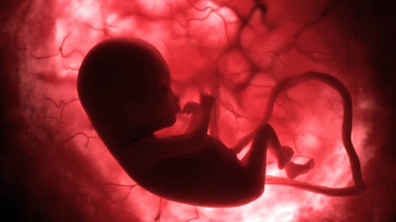 Life Before Birth backdrop