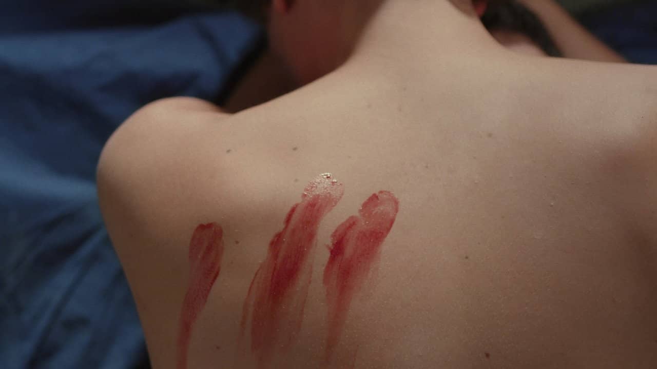 Wound backdrop