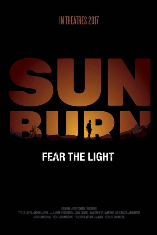 Sunburn