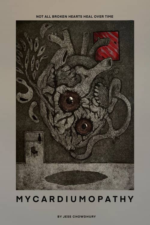Mycardiumopathy