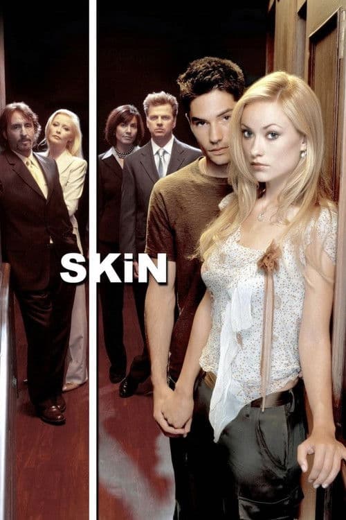 Skin Season 1 poster
